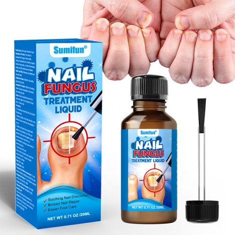 FOURNISSEUR EN CHINE Traitement liquide pour les ongles : Bestseller apaisant, renouvelant les ongles décolorés, fortifiant les ongles cassants, nourrissant les ongles, traitement